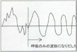 波形２